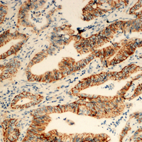 19 - Anti-TUSC3 Antibody AP51593