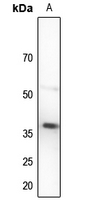 1 - Anti-TUSC3 Antibody AP51593