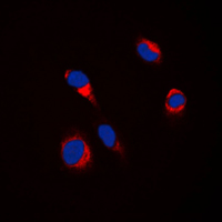 3 - Anti-Tyrosinase Antibody AP51594
