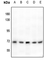 1 - Anti-Tyrosinase Antibody AP51594