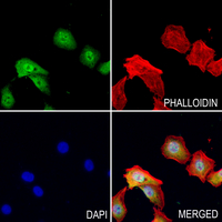 3 - Anti-Ub Antibody AP51595