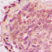 19 - Anti-Ub Antibody AP51595
