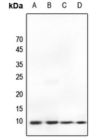 1 - Anti-Ub Antibody AP51595