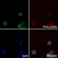 3 - Anti-UBE2A/B Antibody AP51597