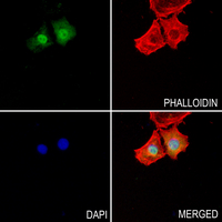 3 - Anti-UBE2D2 Antibody AP51598