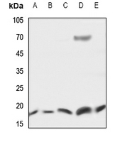 1 - Anti-UBE2D2 Antibody AP51598