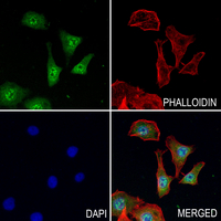 3 - Anti-UBE4A Antibody AP51599