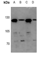 1 - Anti-UBE4A Antibody AP51599