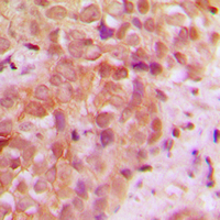 19 - Anti-UBR5 Antibody [KO/KD Validated] AP51600
