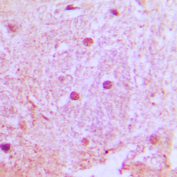 19 - Anti-UBTD1 Antibody AP51601