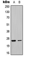 1 - Anti-UBTD1 Antibody AP51601