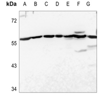 1 - Anti-USP30 Antibody AP51604