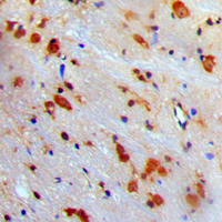 19 - Anti-VCP Antibody AP51607