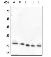 1 - Anti-VEGFB Antibody AP51608