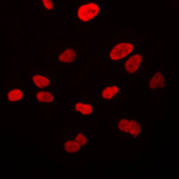 3 - Anti-VWA5A Antibody AP51610