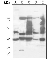 1 - Anti-XPA Antibody AP51614
