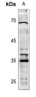 1 - Anti-XRCC2 Antibody AP51616