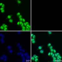3 - Anti-Ku70 Antibody [KO/KD Validated] AP51617