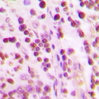 19 - Anti-Ku70 Antibody [KO/KD Validated] AP51617