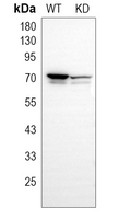 0 - Anti-Ku70 Antibody [KO/KD Validated] AP51617