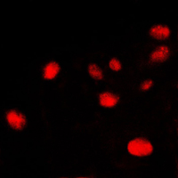3 - Anti-Ku70 Antibody [KO/KD Validated] AP51618