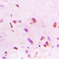 19 - Anti-Ku70 Antibody [KO/KD Validated] AP51618