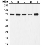 1 - Anti-Ku70 Antibody [KO/KD Validated] AP51618