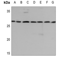 1 - Anti-14-3-3 gamma Antibody [KO/KD Validated] AP51619