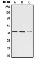 1 - Anti-ZADH2 Antibody AP51620