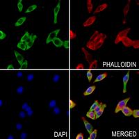 3 - Anti-ZDHHC9 Antibody AP51621