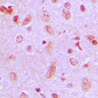 19 - Anti-ZDHHC9 Antibody AP51621