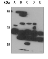 1 - Anti-ZDHHC9 Antibody AP51621