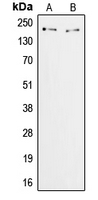 1 - Anti-ZFP106 Antibody AP51622