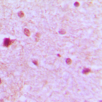 19 - Anti-ZFP36L1 Antibody AP51623