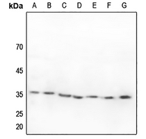 1 - Anti-ZFP36L1 Antibody AP51623