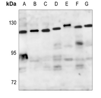 1 - Anti-ZHX2 Antibody AP51624