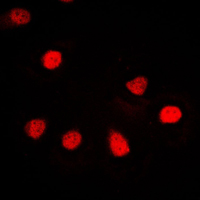 3 - Anti-ZNF187 Antibody AP51625