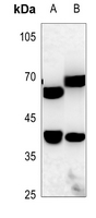 1 - Anti-ZNF187 Antibody AP51625