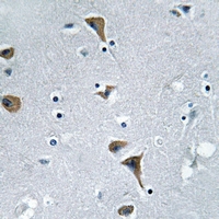 19 - Anti-CSK (Phospho-S364) Antibody AP51626