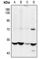 1 - Anti-CSK (Phospho-S364) Antibody AP51626