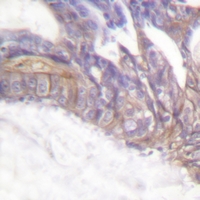 19 - Anti-LAT (Phospho-Y191) Antibody AP51627