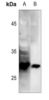 1 - Anti-LAT (Phospho-Y191) Antibody AP51627