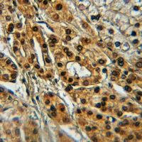 19 - Anti-TIE2 (Phospho-Y1108) Antibody AP51630