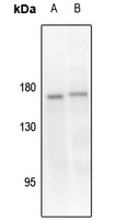 1 - Anti-TIE2 (Phospho-Y1108) Antibody AP51630