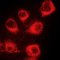 3 - Anti-MYL9 (Phospho-S20) Antibody AP51632