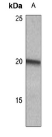 1 - Anti-MYL9 (Phospho-S20) Antibody AP51632