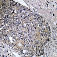 19 - Anti-PAK4 (Phospho-S474) Antibody AP51633