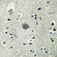 19 - Anti-PLC beta 3 (Phospho-S537) Antibody AP51634