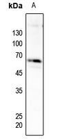 1 - Anti-PFKFB2 (Phospho-S483) Antibody AP51635