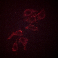 3 - Anti-A-RAF (Phospho-Y302) Antibody AP51636